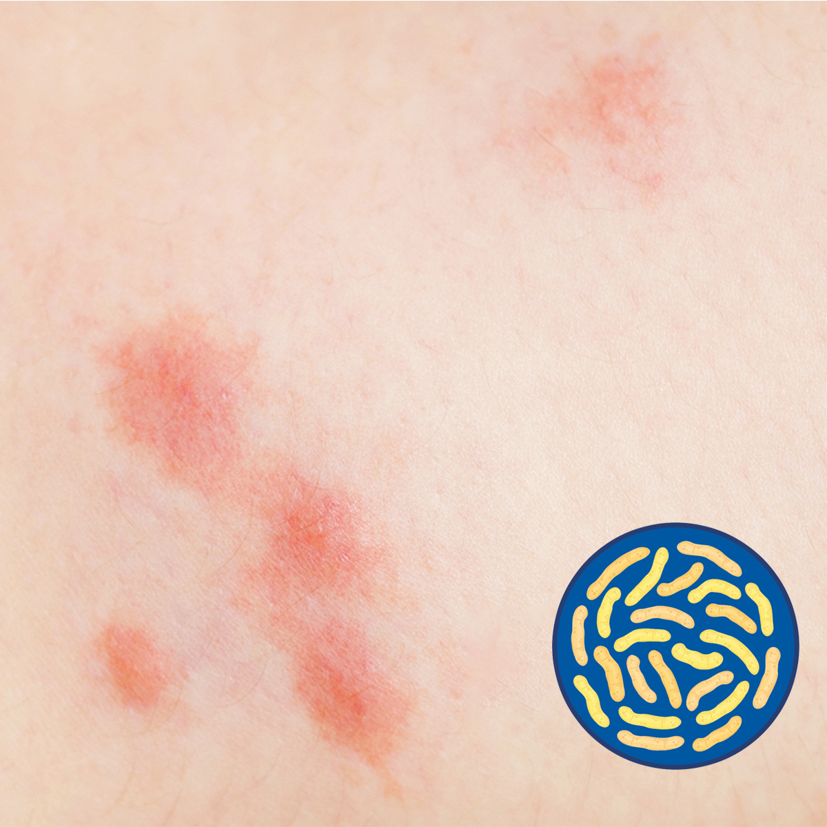 Pó humano Premix probióticos reduz a infecção para crianças e bebê
